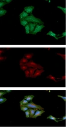 Anti-S100A4 antibody [AT1C3] used in Immunocytochemistry/ Immunofluorescence (ICC/IF). GTX57640