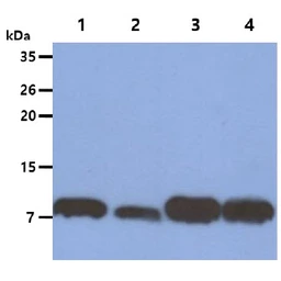 Anti-S100A4 antibody [AT1C3] used in Western Blot (WB). GTX57640