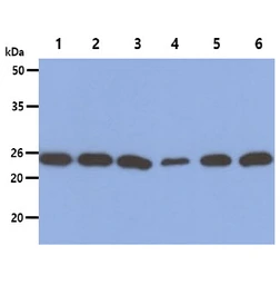 Anti-PSMD10 antibody [AT1F8] used in Western Blot (WB). GTX57642