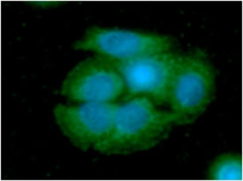 Anti-ARG2 antibody [AT7F8] used in Immunocytochemistry/ Immunofluorescence (ICC/IF). GTX57645