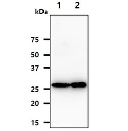 Anti-Adenylate kinase 2 antibody [AT7E7] used in Western Blot (WB). GTX57648