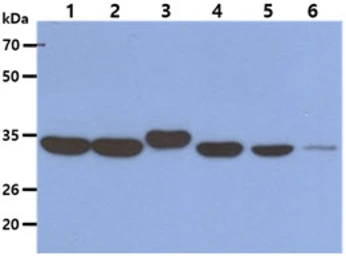 Anti-AIMP1 antibody [AT6D10] used in Western Blot (WB). GTX57649