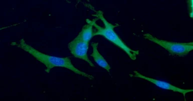 Anti-Aldolase C antibody [AT2E11] used in Immunocytochemistry/ Immunofluorescence (ICC/IF). GTX57650