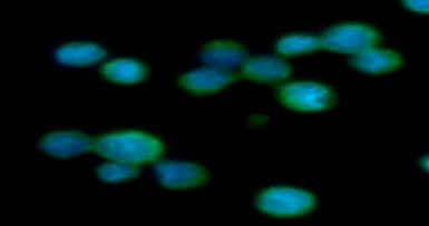 Anti-Aldolase C antibody [AT2E11] used in Immunocytochemistry/ Immunofluorescence (ICC/IF). GTX57650