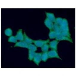 Anti-ALDH5A1 antibody [AT17F5] used in Immunocytochemistry/ Immunofluorescence (ICC/IF). GTX57651