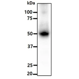 Anti-ALDH5A1 antibody [AT17F5] used in Western Blot (WB). GTX57651