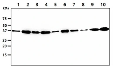 Anti-VTA1 antibody [AT14G10] used in Western Blot (WB). GTX57656