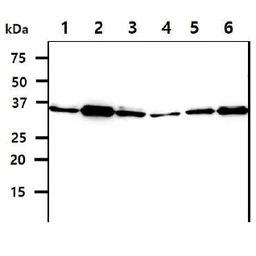 Anti-SGTA antibody [AT19E8] used in Western Blot (WB). GTX57661
