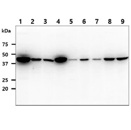 Anti-IDH1 antibody [AT25H10] used in Western Blot (WB). GTX57662