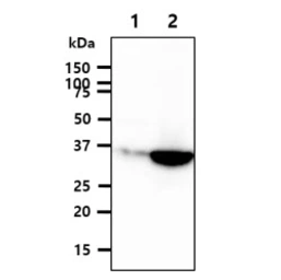 Anti-GPD1L antibody [AT14E2] used in Western Blot (WB). GTX57667