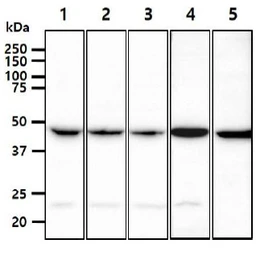 Anti-PGD antibody [AT46B3] used in Western Blot (WB). GTX57669