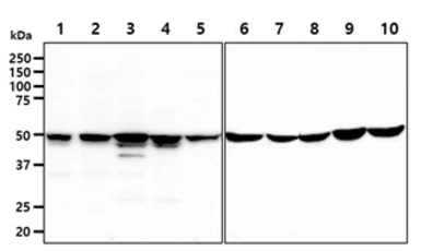 Anti-GSS antibody [AT12F2] used in Western Blot (WB). GTX57671