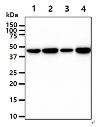 Anti-Creatine kinase (brain) antibody [AT8E4] used in Western Blot (WB). GTX57675