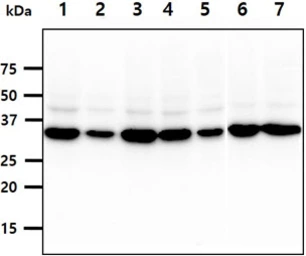 Anti-PPA1 antibody [AT4G4] used in Western Blot (WB). GTX57682