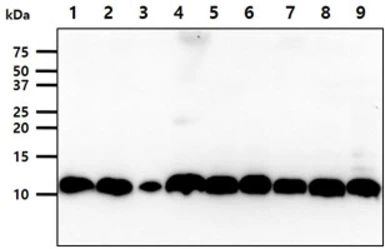 Anti-S100A11 antibody [AT20D11] used in Western Blot (WB). GTX57683