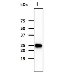 Anti-FKBP14 antibody [AT18E2] used in Western Blot (WB). GTX57684