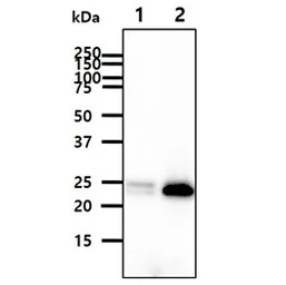 Anti-FKBP14 antibody [AT18E2] used in Western Blot (WB). GTX57684