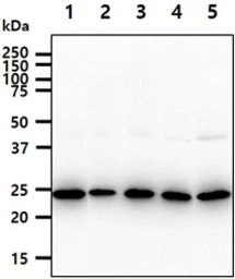 Anti-BAG2 antibody [AT29E9] used in Western Blot (WB). GTX57685