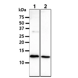 Anti-beta 2 Microglobulin antibody [AT101F10] used in Western Blot (WB). GTX57686