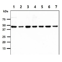 Anti-PSMD11 antibody [AT2C7] used in Western Blot (WB). GTX57692