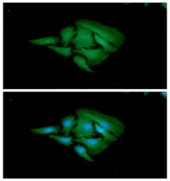 Anti-Adenylate kinase 1 antibody [AT7E9] used in Immunocytochemistry/ Immunofluorescence (ICC/IF). GTX57693
