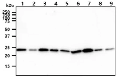 Anti-CINP antibody [AT1G10] used in Western Blot (WB). GTX57694