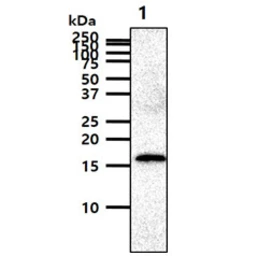 Anti-GMF beta antibody [AT44D8] used in Western Blot (WB). GTX57698