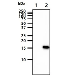 Anti-GMF beta antibody [AT44D8] used in Western Blot (WB). GTX57698