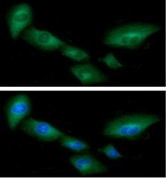 Anti-Heme Oxygenase 1 antibody [AT1D6] used in Immunocytochemistry/ Immunofluorescence (ICC/IF). GTX57699