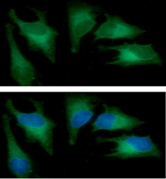 Anti-Heme Oxygenase 1 antibody [AT1D6] used in Immunocytochemistry/ Immunofluorescence (ICC/IF). GTX57699