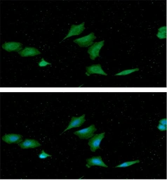 Anti-nm23-H1 antibody [AT5F4] used in Immunocytochemistry/ Immunofluorescence (ICC/IF). GTX57703