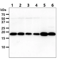 Anti-nm23-H1 antibody [AT5F4] used in Western Blot (WB). GTX57703