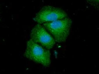 Anti-ACSF2 antibody [AT18B4] used in Immunocytochemistry/ Immunofluorescence (ICC/IF). GTX57705