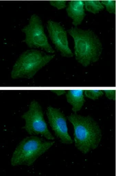 Anti-RAB7A antibody [AT10E4] used in Immunocytochemistry/ Immunofluorescence (ICC/IF). GTX57709