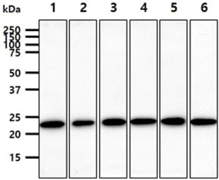 Anti-RAB7A antibody [AT10E4] used in Western Blot (WB). GTX57709