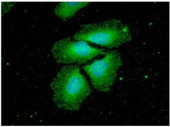 Anti-nm23-H2 antibody [AT2E3] used in Immunocytochemistry/ Immunofluorescence (ICC/IF). GTX57712