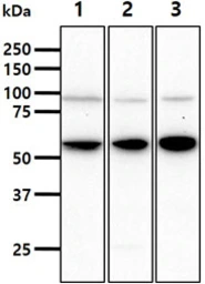 Anti-STCH antibody [AT2F6] used in Western Blot (WB). GTX57713