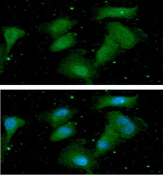 Anti-AKT1 + AKT3 antibody [AT6D5] used in Immunocytochemistry/ Immunofluorescence (ICC/IF). GTX57714