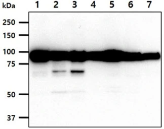 Anti-Calnexin antibody [AT18B9] used in Western Blot (WB). GTX57717