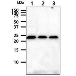 Anti-CD94 antibody [AT13E3] used in Western Blot (WB). GTX57720