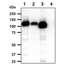 Anti-Hexokinase I + Hexokinase II + Hexokinase III antibody [AT4C12] used in Western Blot (WB). GTX57726