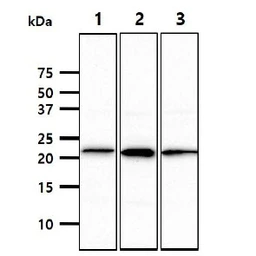 Anti-NCR3 antibody [AT38D9] used in Western Blot (WB). GTX57732