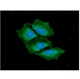 Anti-DcR1 antibody [AT1E12] used in Immunocytochemistry/ Immunofluorescence (ICC/IF). GTX57733