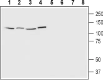 Anti-EphA1 antibody used in Western Blot (WB). GTX57738
