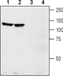 Anti-EphA1 antibody used in Western Blot (WB). GTX57738