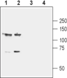 Anti-EphB1 antibody used in Western Blot (WB). GTX57739