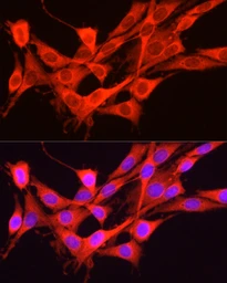 Anti-GCN2 antibody used in Immunocytochemistry/ Immunofluorescence (ICC/IF). GTX57741