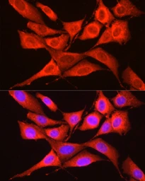 Anti-GCN2 antibody used in Immunocytochemistry/ Immunofluorescence (ICC/IF). GTX57741