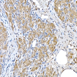Anti-GCN2 antibody used in IHC (Paraffin sections) (IHC-P). GTX57741