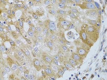 Anti-HDAC8 antibody used in IHC (Paraffin sections) (IHC-P). GTX57746